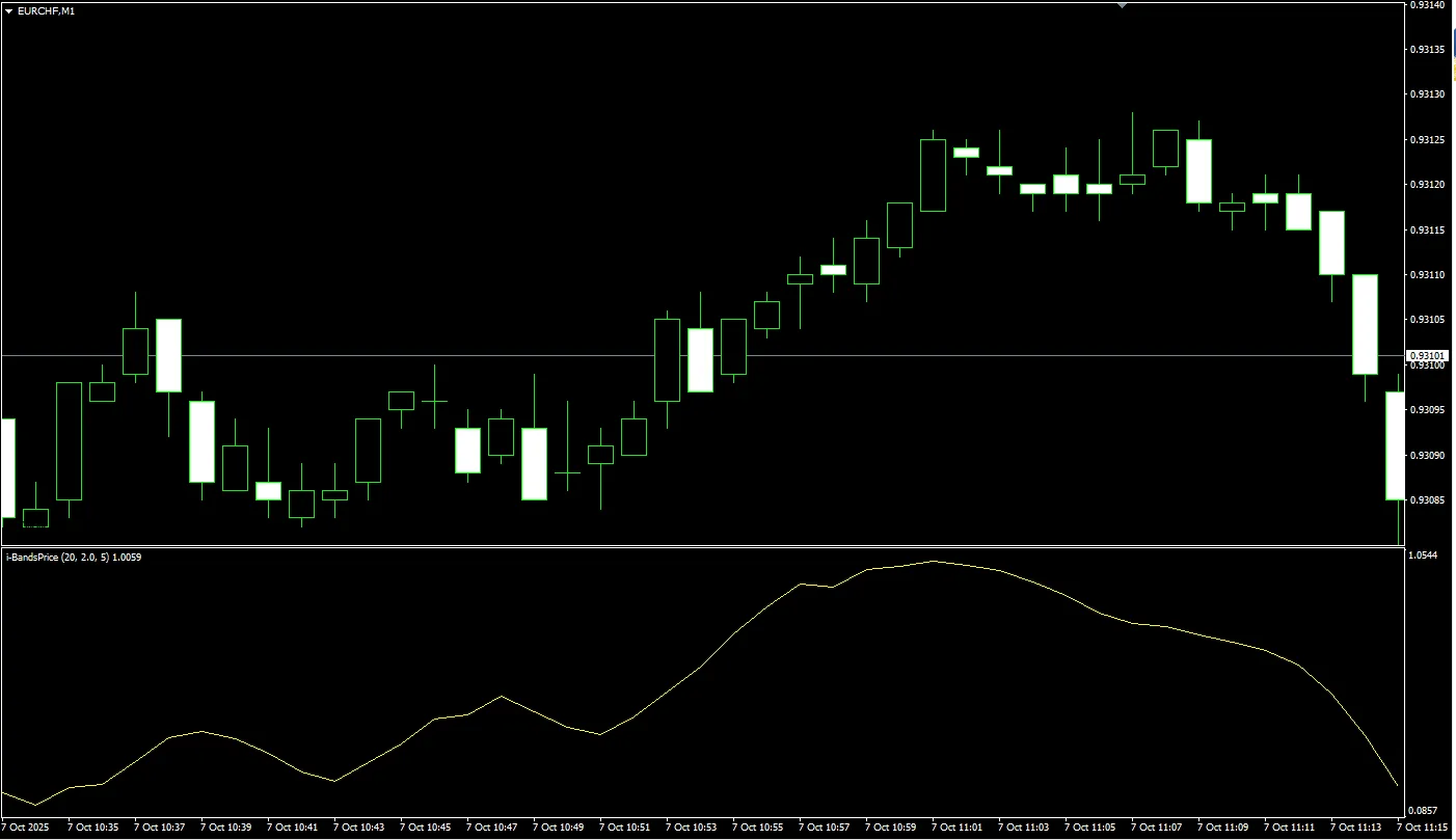 I-Bands Price